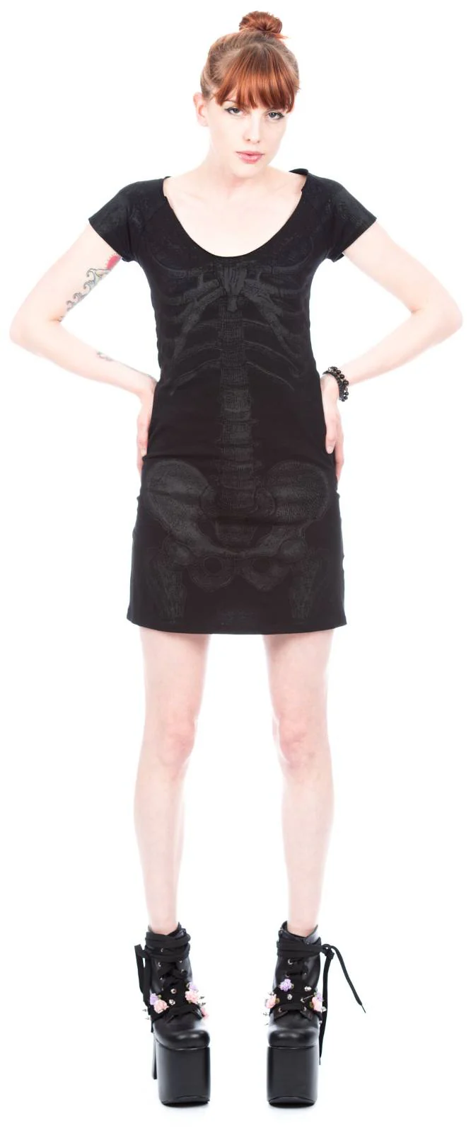 Skeleton Tunic Dress - Stripe - Image 10